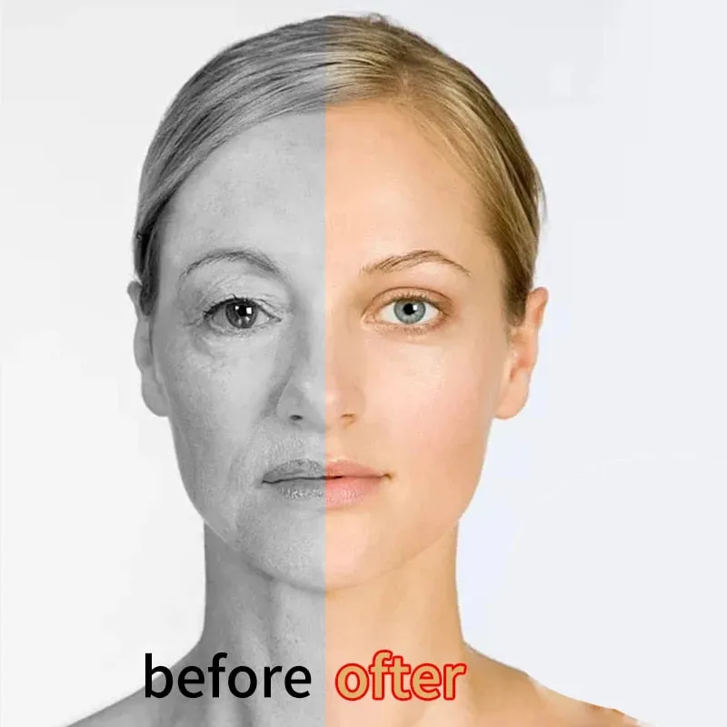 Face Collagen Cream Anti Wrinkle Anti Aging Retinol Dark Spot Remover For Face Serum Whitening Cream Face Creams Skin Care